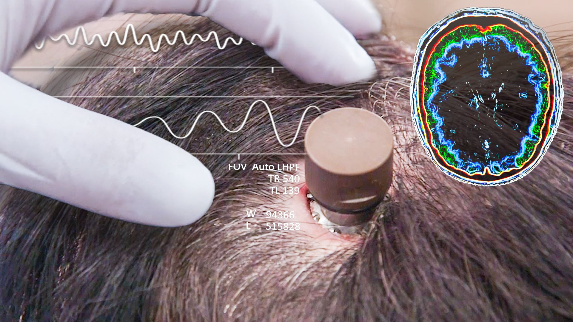 wired_wired-news-and-science-the-science-behind-elon-musks-neuralink-brain-chip